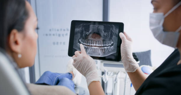 Licensed Teeth Whitening service in New London, OH - Smile Center Dentistry